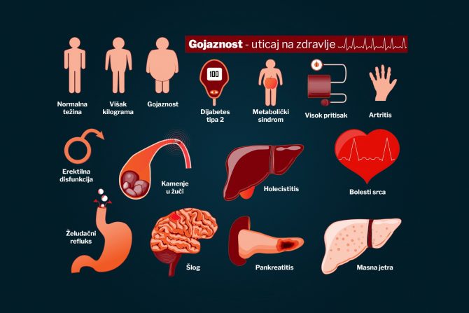gojaznost i žučna kesa- dijabetes i problemi sa žučnom kesom