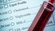 Savet lekara kako najbolje da kontrolišete nivo triglicerida i holesterola