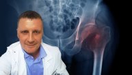 Prelom kuka kod starijih ljudi može da izazove čak i oslanjanje na nogu, a zašto je tako priča nam dr Borislav Despot