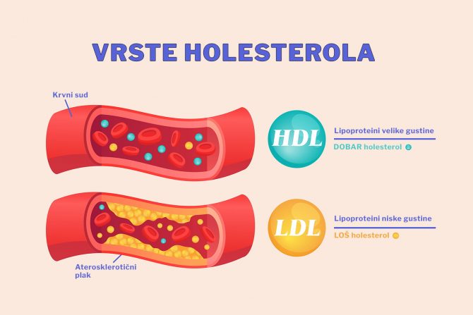 šta je LDL holesterol- HDL holesterol-vrste holesterola-
