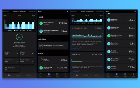 lečenje na daljinu-telemedicina- kućni medicinski aparti