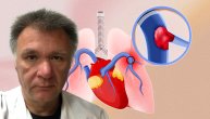 Tromboembolijska bolest pluća može da se leči balon angioplastikom, a stručnjak za to je dr Slobodan Obradović