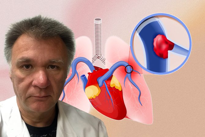 Prof.dr Slobodan Obradović, tromboembolijska bolest pluća