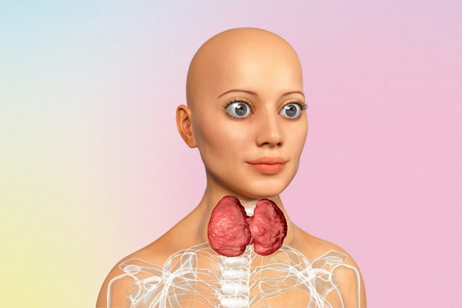 gravesova bolest- štitna žlezda- ispupčene oči