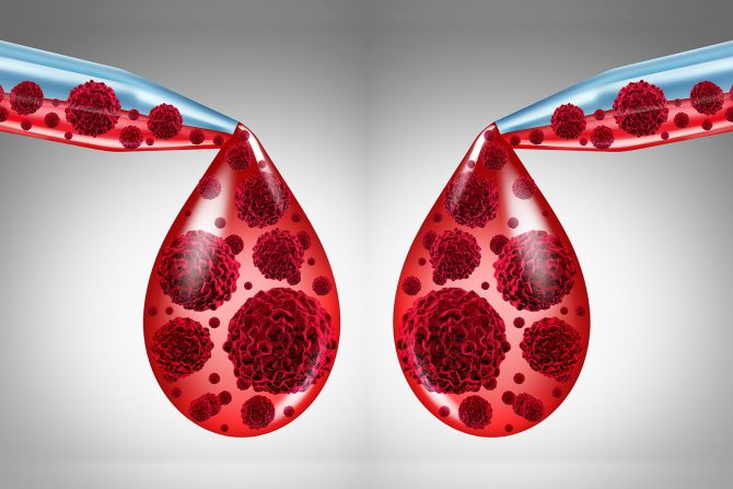 karcinom krvi-rak krvi