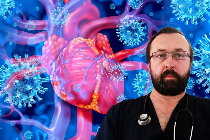 miokarditis -srce-covid 19