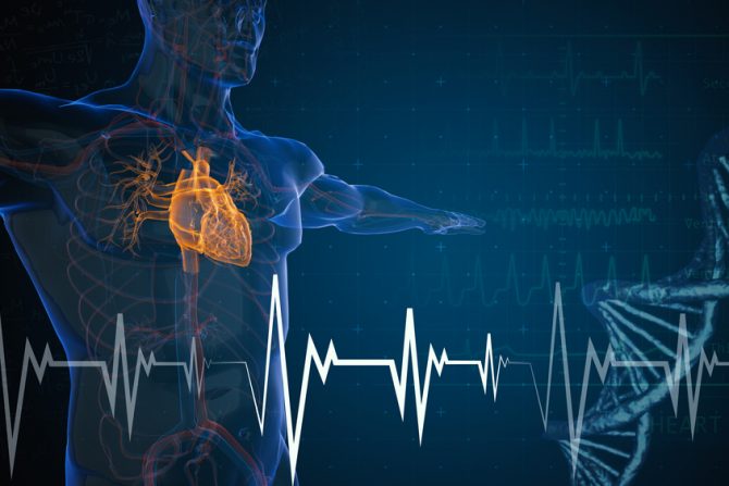 srčani udar - razlozi nastanka