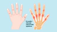 14 razloga zbog kojih nam otiču prsti na rukama