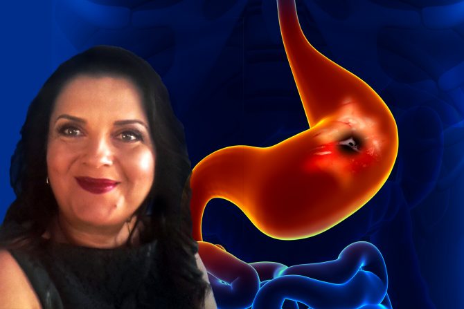 Dr Tatjana Radaljac, peptički ulkus, čir