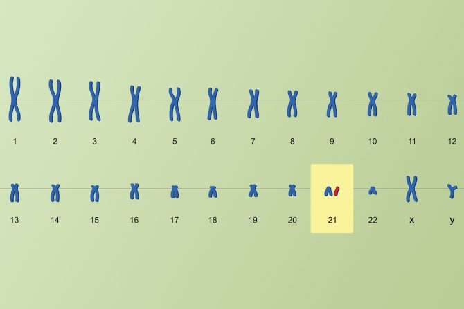 Daunov sindrom, hromozomi