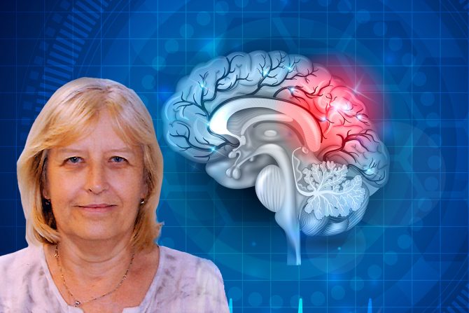 moždani udar -prevencija