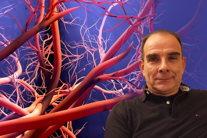 šta je vaskularna starost