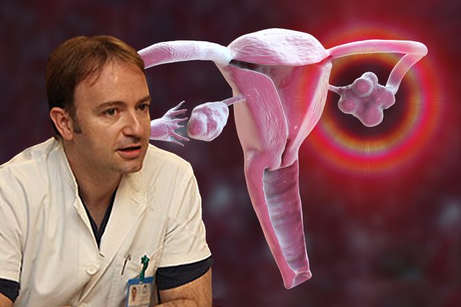 Sindrom policističnih jajnika, dr Radomir Aničić