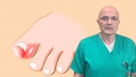 Urasli nokat zbog nestručnog lečenja može izazvati hepatitis C ili B, naglašava dr Slaven Radulović
