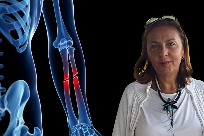 Dragana Bogdanović, rehabilitacija