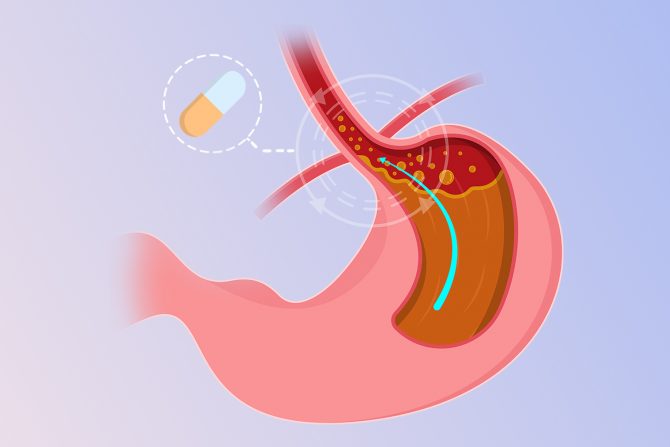 Zolinger-Ellisonov sindrom