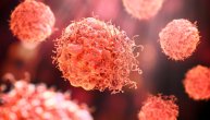 Sarkom je agresivan tumor koji počinje u kostima i mekim, vezivnim tkivima