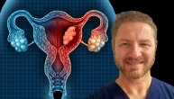 Karcinom grlića materice prepoznaje se po jasnim simptomima, a dr Nenad Dimitrijević ističe da tada može da bude kasno