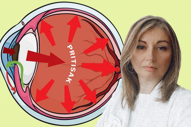 visok očni pritisak