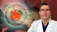 Karcinom pankreasa je, nažalost, asimptomatska bolest, podseća dr Daniel Galun