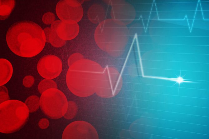 ženama preti šlog i visok pritisak