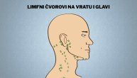 Otečeni limfni čvorovi na vratu mogu da budu simptom covid 19