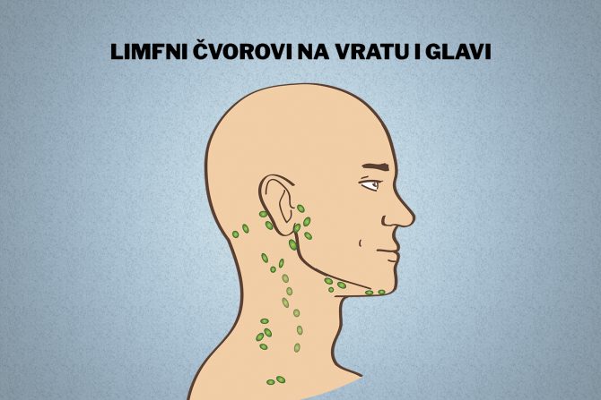 Otečeni limfni čvorovi na vratu