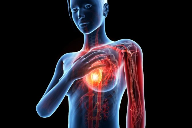 Kardiovaskularne bolesti