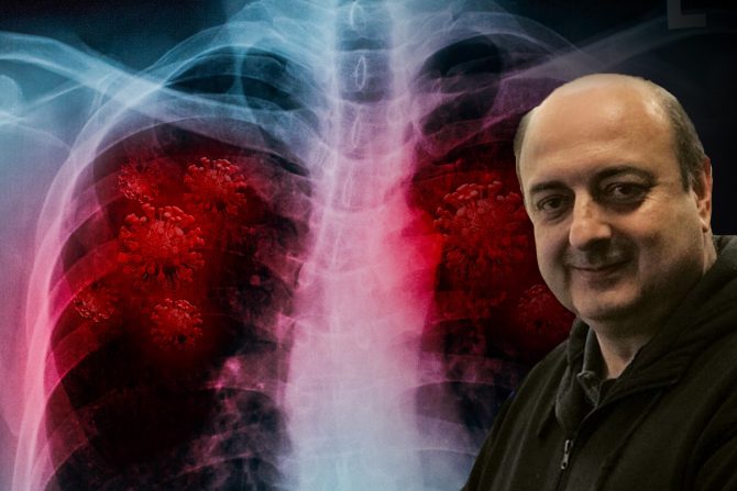 Omikron soj, pneumonija