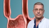 Аhalazija jednjaka otežava gutanje i normalan prolazak hrane u želudac, pojašnjava dr Aleksandar Simić