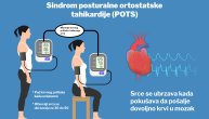 Sindrom posturalne ortostatske tahikardije zadržava krv u donjem delu tela