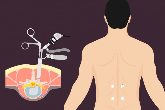 Bol u donjem delu leđa