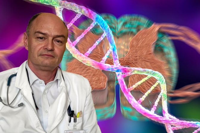 Skrining SMA, prof.dr Dimitrije Nikolić