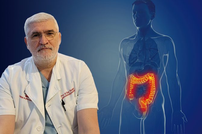 Zapaljenske bolesti creva, profesor Dino Tarabar