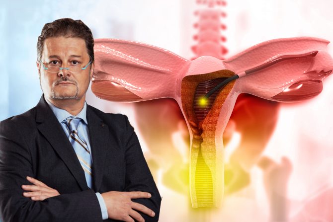 Histeroskopija, dr Miloš Radović