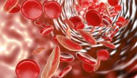 Anemija i ishrana su povezane jer neke namirnice nadoknađuju nedostatak gvožđa