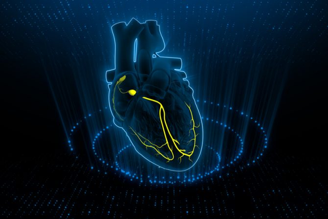 iznenadna srčana smrt