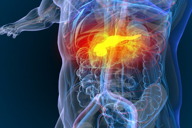 najraniji znaci raka pankreasa