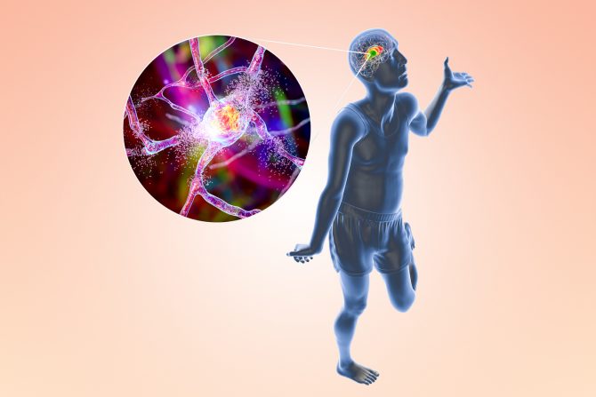 hantingtonova bolest