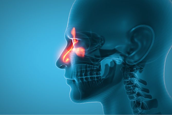rak nosa i sinusa