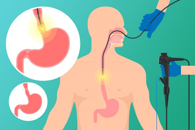 Manometrija jednjaka