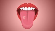 Uzroci pojave raka jezika i ko je u posebnom riziku