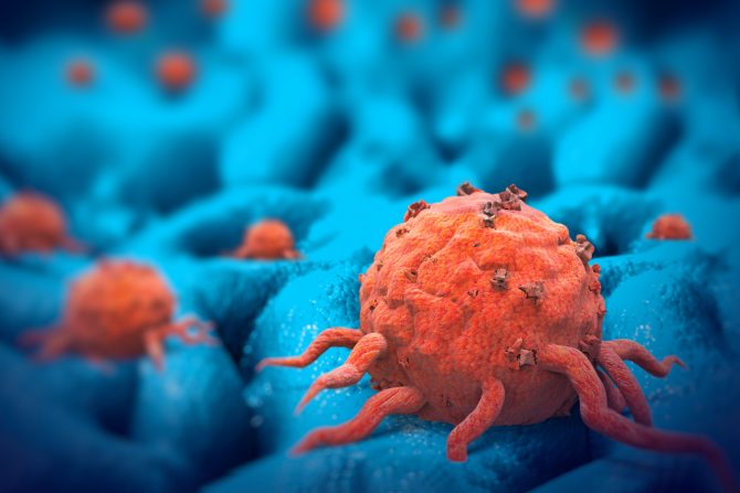 metastatski karcinom pluća