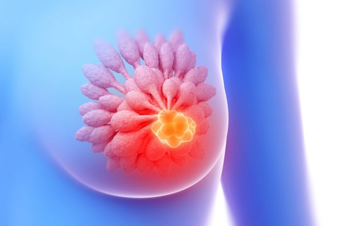 Rak dojke pozitivan na hormonske receptore