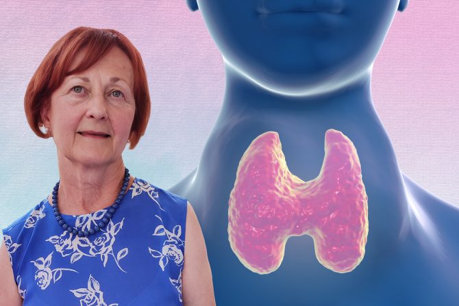 Hipertireoza, prof. dr Jasmina Ćirić