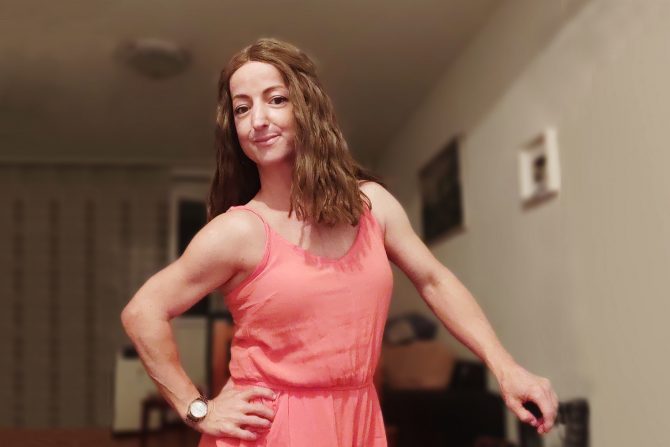 Progerija, Ivana Stojanović