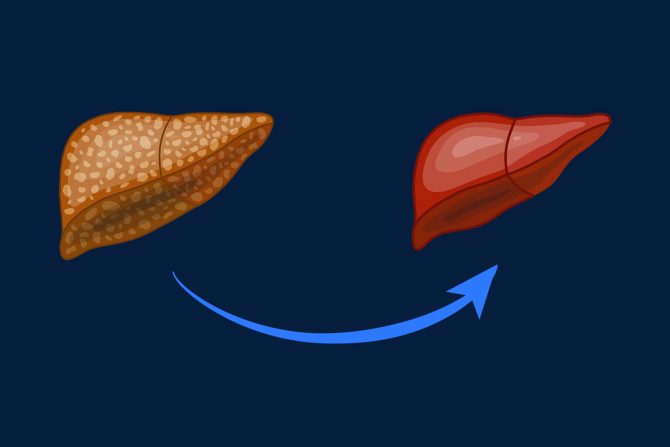 transplatacija jetre