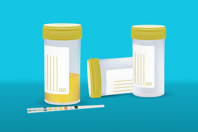 beli tragovi u mokraći