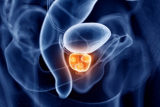 rak prostate
