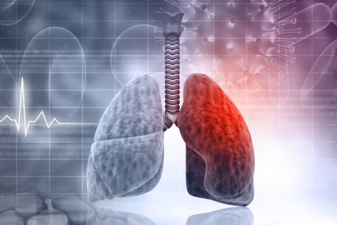 plućna arterijska hipertenzija